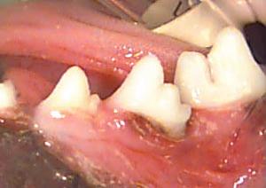 Stage 3 Teeth